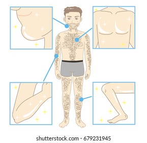 Men's Beauty depilation / whole body and Every part of the body