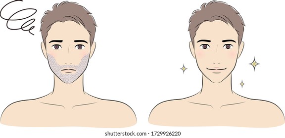 men's facial hair or beard removal before after concept, vector illustration