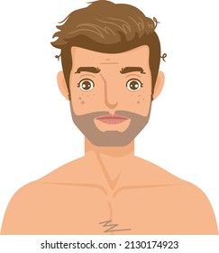 men's facial skin problems vector