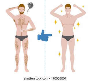 Laser Hair Removal For Men Images Stock Photos Vectors