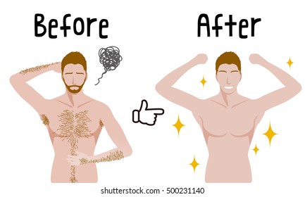 54 Laser Hair Removal Male Chest Stock Vectors, Images & Vector Art |  Shutterstock