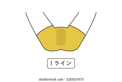 Men's Hair Removal, I-Line, with Underwear - Translation: I-line