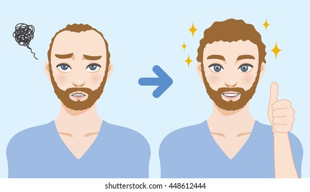 men's thinning hair treatment before after image illustration