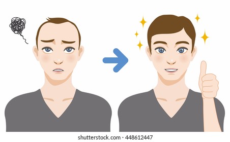 men's thinning hair treatment before after image illustration