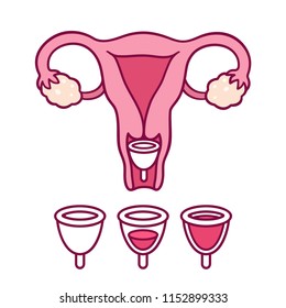 Menstrual cup use, feminine period hygiene product. Empty and full cup drawing with uterus and cervix diagram. Hand drawn cartoon style vector illustration.