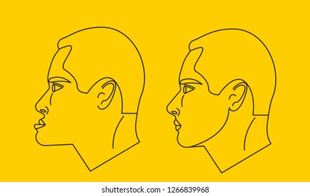Mesial bite, man with malocclusion, lower jaw extended forward, bite correction by braces. Vector illustration