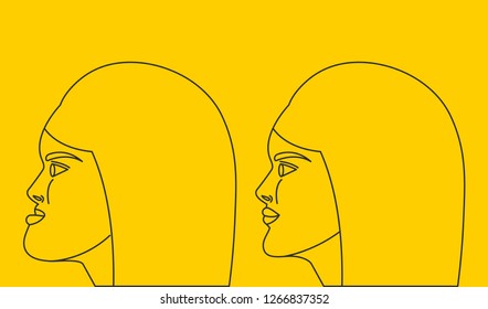 Mesial bite, woman with malocclusion, lower jaw extended forward, bite correction by braces. Vector illustration