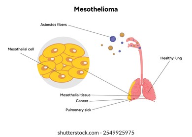 Mesothelioma disease, lung problems, healthy lungs	
