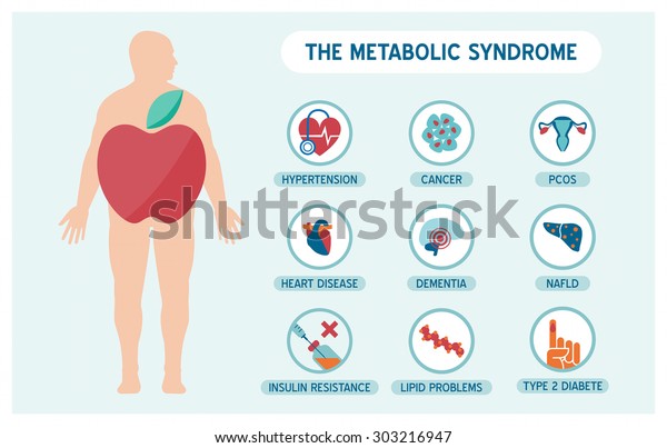 The metabolic syndrome\
infographics with disease medical icons, fat male body and apple\
shape