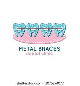 Metal braces. Cartoon teeth. Vector illustration.