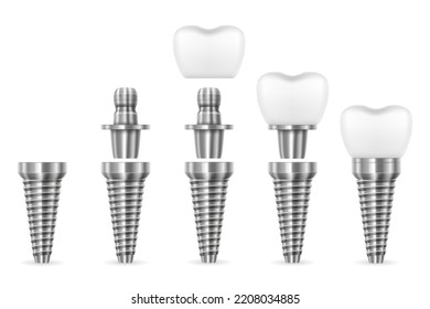 metal human tooth implant vector illustration isolated on white background