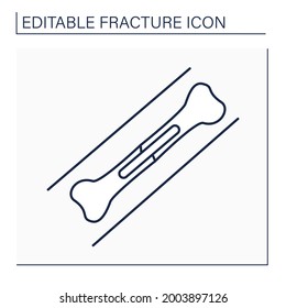 Metal plates line icon. Implanted metal can help broken bones heal in proper alignment.Treatment. Healthcare concept. Isolated vector illustration. Editable stroke