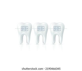 Metallic braces on white teeth. Cure orthodontic dentistry medical treatment set realistic. Human tooth and aesthetic brackets. Healthcare and beauty. Oral fix correction. Vector illustration