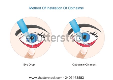 Method of instillation of opthalmic. Correct use of eye drops and opthalmic ointment.Concept of eye treatment, eye inflammation, eye fatigue, care, vision and health.vector illustration.