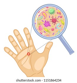 Microbes on hand cartoon vector illustration isolated from background. Number of dangerous germs or bacteria are visible on hand under magnifying glass.