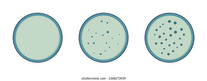 Microbiology. Colony bacteria growth in petry dish, 3 stages, vector flat style