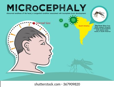 Microcephaly or Abnormal Smallness of the Head Concept. The Zika Fever Virus is linked to microcephaly birth defect cases from pregnant women bitten by Aedes aegypti mosquitoes. Editable Clip Art