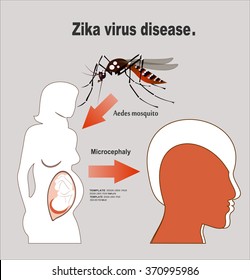 Microcephaly or Abnormal Smallness of the Head Concept. The Zika Fever Virus is linked to microcephaly birth defect cases from pregnant women bitten by Aedes aegypti mosquitoes.