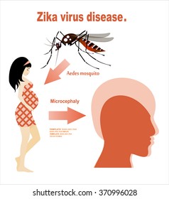 Microcephaly or Abnormal Smallness of the Head Concept. The Zika Fever Virus is linked to microcephaly birth defect cases from pregnant women bitten by Aedes aegypti mosquitoes.