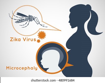 Microcephaly or Abnormal Smallness of the Head Concept. The Zika Fever Virus is linked to microcephaly birth defect cases from pregnant women bitten by Aedes aegypti mosquitoes.