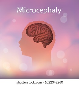 Microcephaly. Blurred pink background. Silhouette of child head, brain.