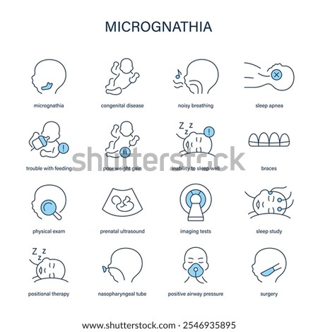 Micrognathia symptoms, diagnostic and treatment vector icon set. Medical icons.
