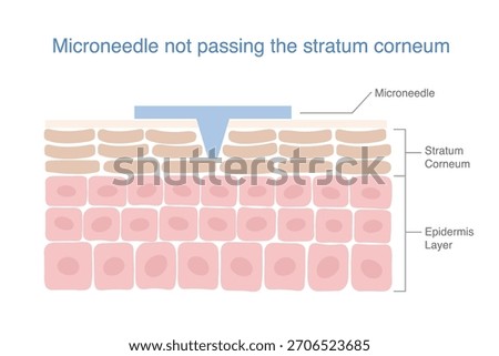 Microneedle insert into layer skin structure passed to Stratum Corneum  before epidermis. Medical nano needle for maintaining the penetration of the beauty ingredients for Smooth skin, anti aging.