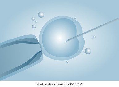 Microscopic artificial insemination, In vitro fertilisation (IVF) - vector illustration