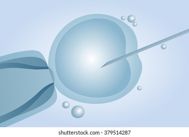 Microscopic artificial insemination, In vitro fertilisation (IVF) - vector illustration
