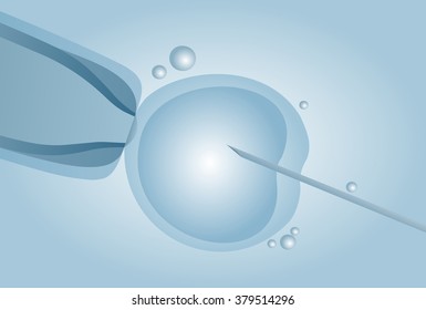 Microscopic artificial insemination, In vitro fertilisation (IVF) - vector illustration
