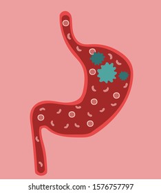 Microscopic bacteria. Microflora, viruses in the intestines. Vector flat cartoon icon illustration. Microflora of the human intestine. Gastrointestinal tract or alimentary canal. Cancer.