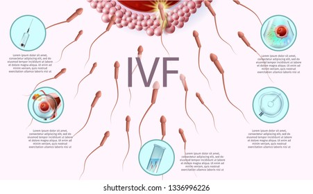 Microscopic Research View of In Vitro Fertilization Process Close Up. Laboratory Equipment and Stages of IVF Icons. Vector Realistic Illustration. Human Reproductive Medicine Banner with Copy Space.