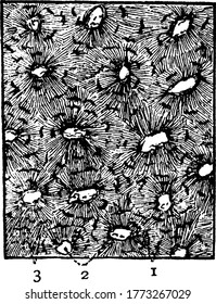A microscopic view of the cross-section of bone, with markings, '1, 2 and 3', representing, cells, canals and intercellular substance, respectively, vintage line drawing or engraving illustration