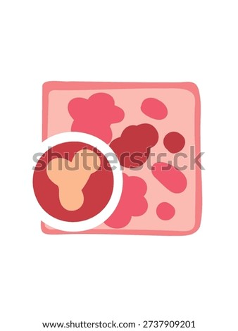 microscopic view of enlarged cancer cells