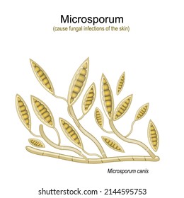 Microsporum, under microscope. Microscopic fungi that cause infections of scalp, skin of body and feet. vector  illustration