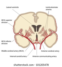 Middle cerebral artery and branches