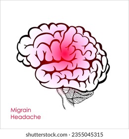 Migraine headache. Red Pain center in the human brain concept. Vector graphic illustration isolated on white for poster, medicine packaging, book design. realistic brain diagram