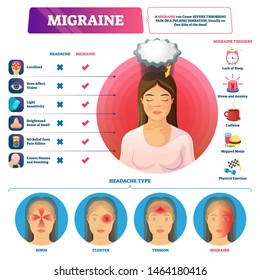 Migraine vector illustration. Labeled abdominal headache triggers and types scheme. Visualized sinus, cluster and tension pulsation head feelings. Educational strong severe throbbing pain comparison.