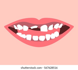 Milk tooth and permanent teeth in eruption. Kid smile. Vector illustration flat design