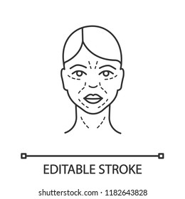 Mimic Wrinkles Linear Icon. Facial Skin After Thirty. Thin Line Illustration. Face Ageing. Facial Markup For Cosmetic Procedure. Contour Symbol. Vector Isolated Outline Drawing. Editable Stroke