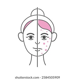 Minimalist before and after skincare illustration in a modern, thin-line style with pink accents. 