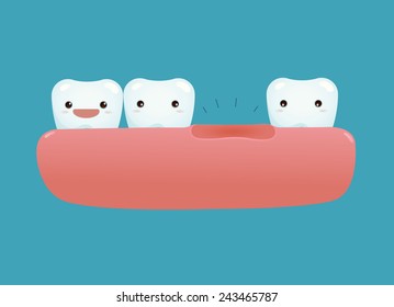 Missing tooth of dental 