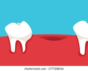 Missing tooth in the mouth. Flat vector illustration in cartoon style.