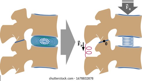 Mobile Segment-vertebral Functional Unit. Its A First-class Lever That Is Formed By: Two Adjacent Vertebrae, The Intervertebral Disc,  The Ligamentous Apparatus And The Zygapophysial Joint (or Facet J