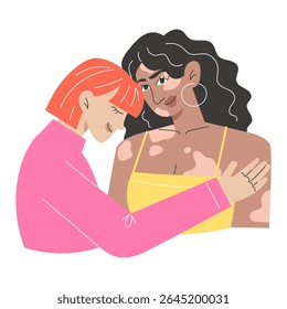 Modern Flat Style Illustration of Interracial Lesbian Couple with Vitiligo Representing LGBTQ Diversity and Equality