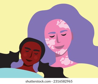 Modern natural mother with vitiligo hugging baby as a multicultural family, flat vector stock illustration