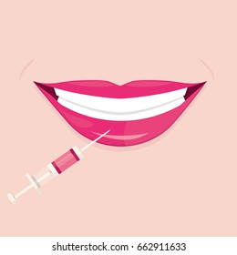 Modern vector illustration of lips injections. Lip augmentation. Hyaluronic Acid injections
