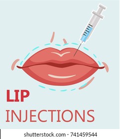 Modern vector illustration of lips injections. Lip augmentation. Hyaluronic Acid injections