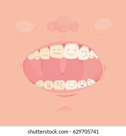 Modern vector illustration of open cute mouth with cartoon friendly teeth.Before and After Bleaching treatment. Teeth whitening