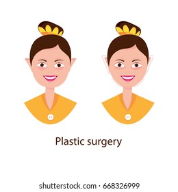 Modern vector illustration of Plastic surgery. Eyes, face, lips. Cosmetology facial procedure.